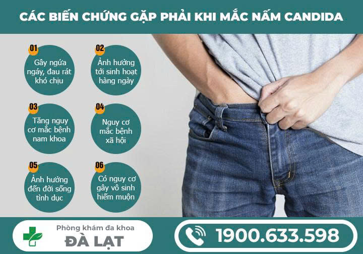 Hình ảnh minh họa